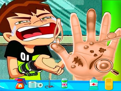 Play Ben10 Hand Doctor Game